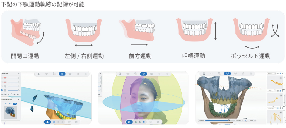 メティスマイル ジョーモーション