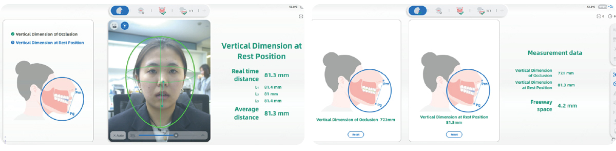 メティスマイル ジョーモーション