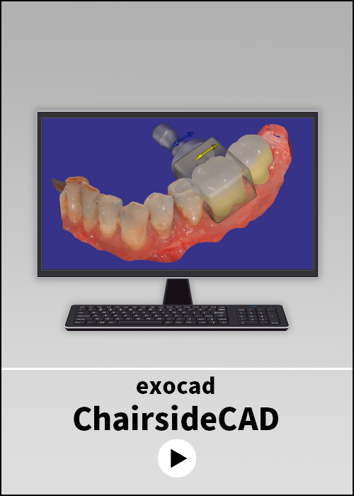 歯科製品情報 | CADCAM